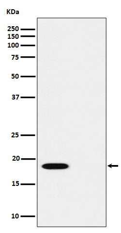 Anti-Phospho-PTS (S19) Rabbit Monoclonal Antibody Boster Bio