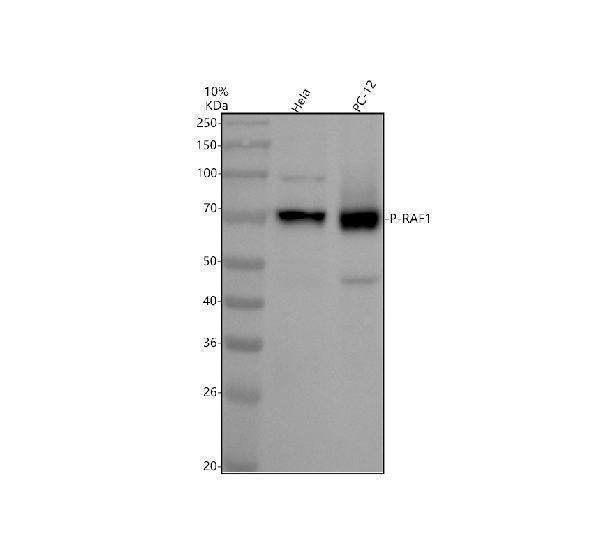 Anti-Phospho-Raf1 (S43) Rabbit Monoclonal Antibody Boster Bio