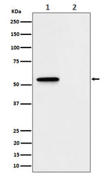 Anti-Phospho-MLKL (S345) Rabbit Monoclonal Antibody Boster Bio