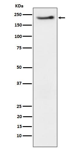 Anti-Phospho-ErbB3 (Y1222) Rabbit Monoclonal Antibody Boster Bio