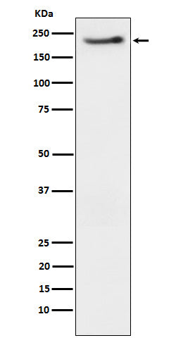 Anti-Phospho-ErbB3 (Y1222) Rabbit Monoclonal Antibody Boster Bio