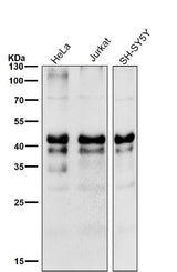 Anti-Phospho-Creb (S133) CREB1 Rabbit Monoclonal Antibody Boster Bio