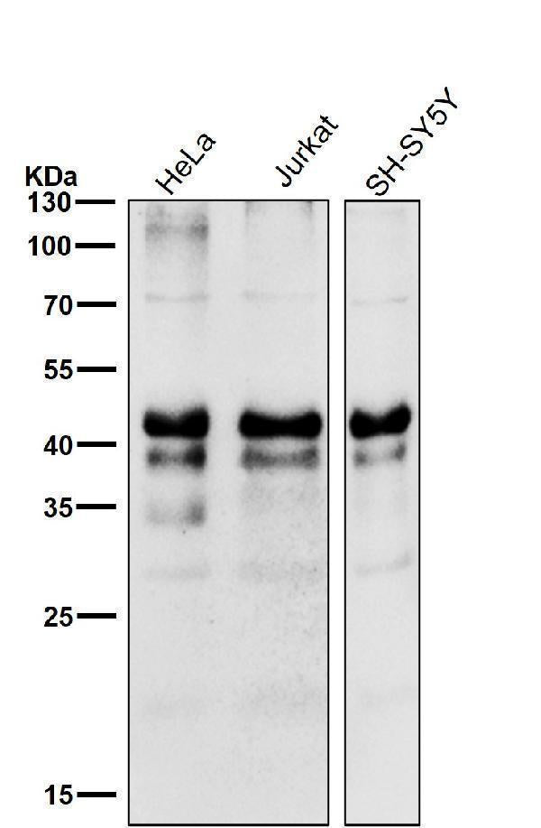 Anti-Phospho-Creb (S133) CREB1 Rabbit Monoclonal Antibody Boster Bio