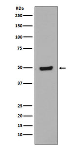Anti-Phospho-GATA3 (S308) Rabbit Monoclonal Antibody Boster Bio