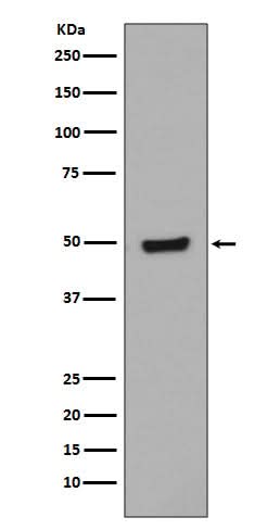 Anti-Phospho-GATA3 (S308) Rabbit Monoclonal Antibody Boster Bio