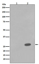 Anti-Phospho-Hsp27 (S78) HSPB1 Rabbit Monoclonal Antibody Boster Bio