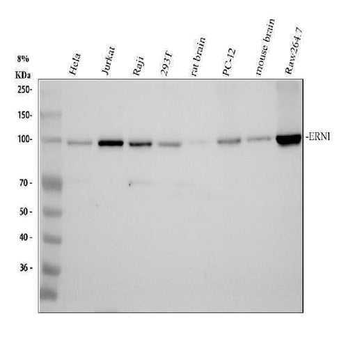 Anti-Phospho-IRE1 (S724) ERN1 Rabbit Monoclonal Antibody Boster Bio