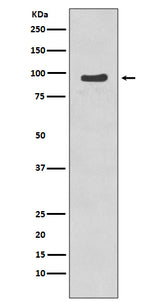 Anti-Phospho-p95/NBS1 (S343) NBN Rabbit Monoclonal Antibody Boster Bio