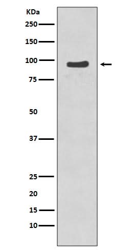 Anti-Phospho-p95/NBS1 (S343) NBN Rabbit Monoclonal Antibody Boster Bio