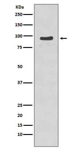 Anti-Phospho-p95/NBS1 (S343) NBN Rabbit Monoclonal Antibody Boster Bio