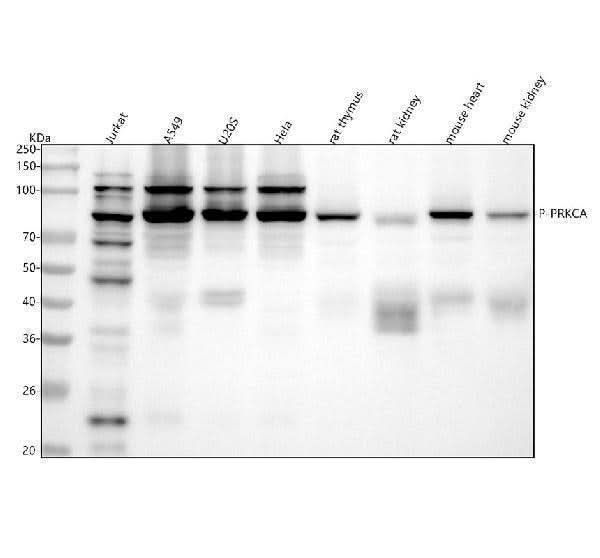 Anti-Phospho-PKC alpha (T638) PRKCA Rabbit Monoclonal Antibody Boster Bio