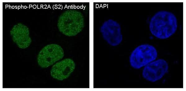 Anti-Phospho-POLR2A (S2) Rabbit Monoclonal Antibody Boster Bio