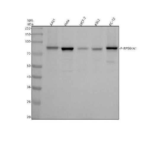 Anti-Phospho-RSK1 (S380) RPS6KA1 Rabbit Monoclonal Antibody Boster Bio