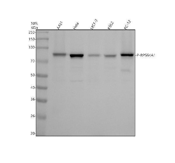 Anti-Phospho-RSK1 (S380) RPS6KA1 Rabbit Monoclonal Antibody Boster Bio