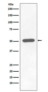 Anti-Phospho-Chk1 (S296) CHEK1 Rabbit Monoclonal Antibody Boster Bio