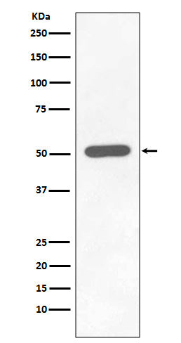 Anti-Phospho-Chk1 (S296) CHEK1 Rabbit Monoclonal Antibody Boster Bio