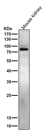Anti-Phospho-Stat5 (Y694) STAT5A Rabbit Monoclonal Antibody Boster Bio