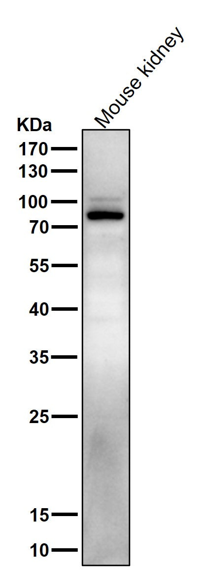 Anti-Phospho-Stat5 (Y694) STAT5A Rabbit Monoclonal Antibody Boster Bio