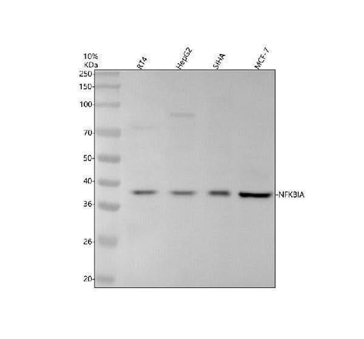Anti-Phospho-IKB alpha (S36) Rabbit Monoclonal Antibody Boster Bio