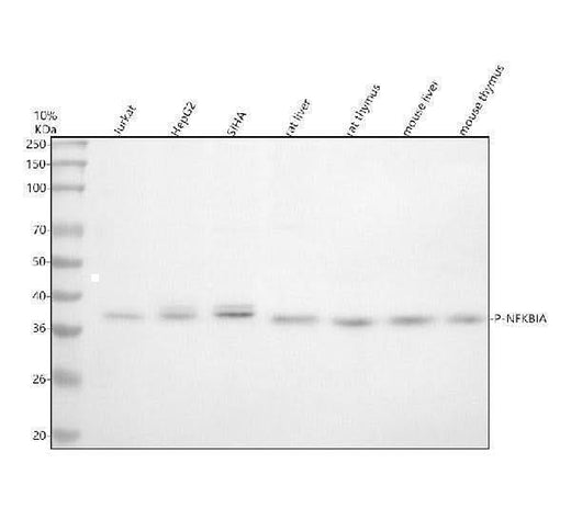 Anti-Phospho-IKB alpha (S32) NFKBIA Rabbit Monoclonal Antibody Boster Bio
