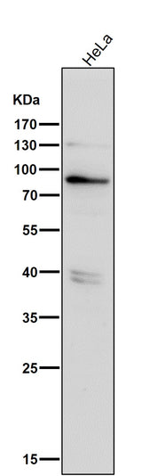Anti-Phospho-PKR (T446) EIF2AK2 Rabbit Monoclonal Antibody Boster Bio