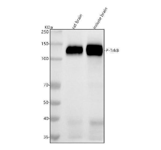 Anti-Phospho-TrkB (Y817) NTRK2 Rabbit Monoclonal Antibody Boster Bio
