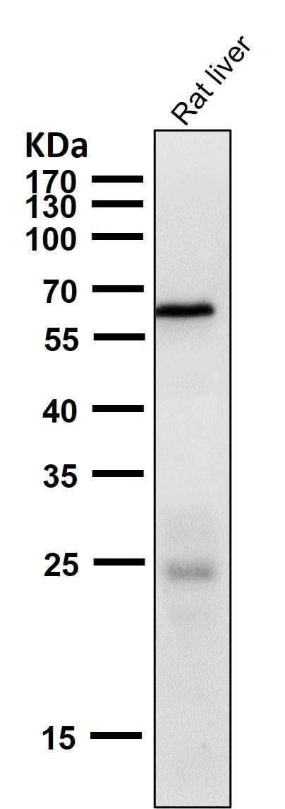 Anti-Phospho-AMPK alpha 2 (S491) PRKAA2 Rabbit Monoclonal Antibody Boster Bio