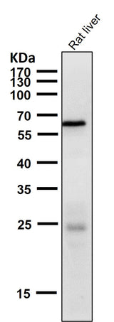 Anti-Phospho-AMPK alpha 2 (S491) PRKAA2 Rabbit Monoclonal Antibody Boster Bio