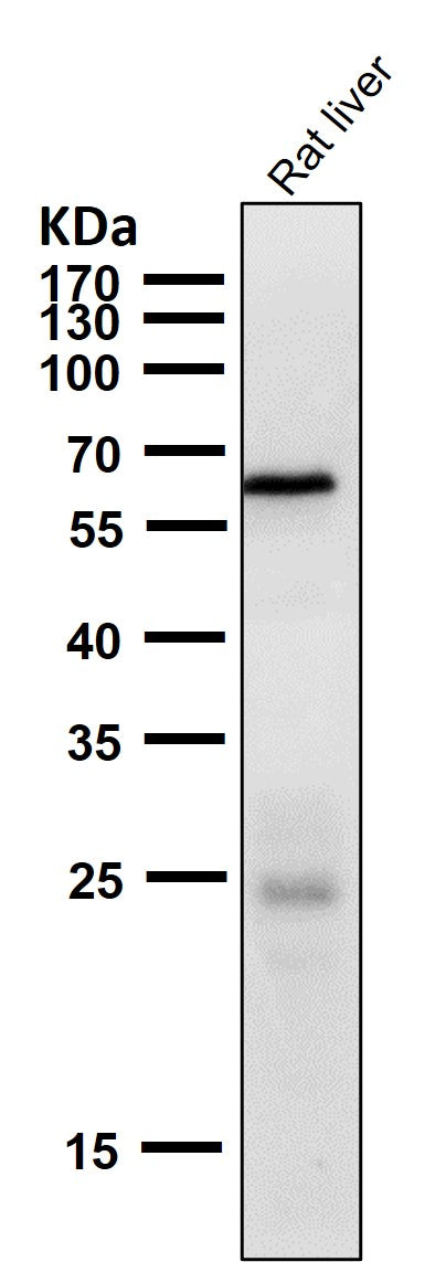 Anti-Phospho-AMPK alpha 2 (S491) PRKAA2 Rabbit Monoclonal Antibody Boster Bio