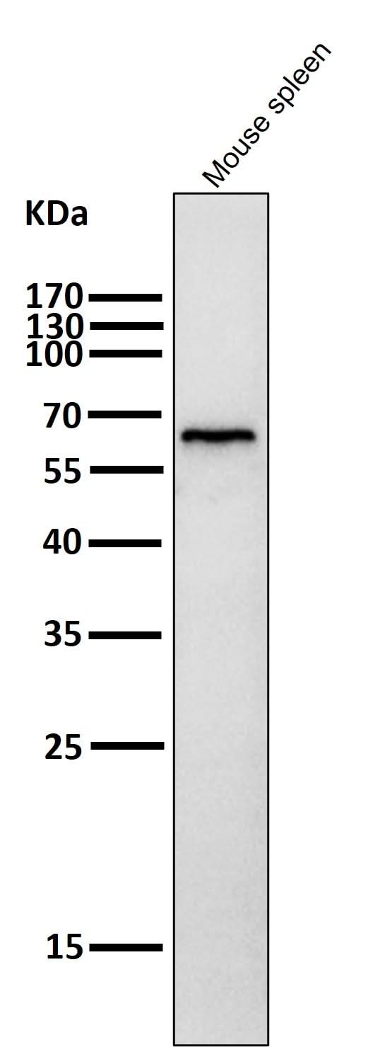 Anti-Phospho-AMPK alpha (T172) PRKAA2 Rabbit Monoclonal Antibody Boster Bio