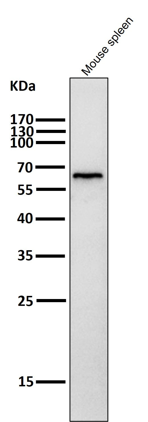 Anti-Phospho-AMPK alpha (T172) PRKAA2 Rabbit Monoclonal Antibody Boster Bio