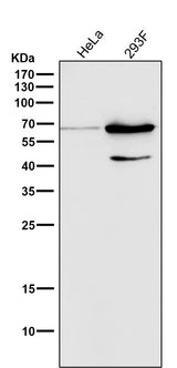 Anti-Phospho-AMPK alpha 2 (S345) PRKAA2 Rabbit Monoclonal Antibody Boster Bio