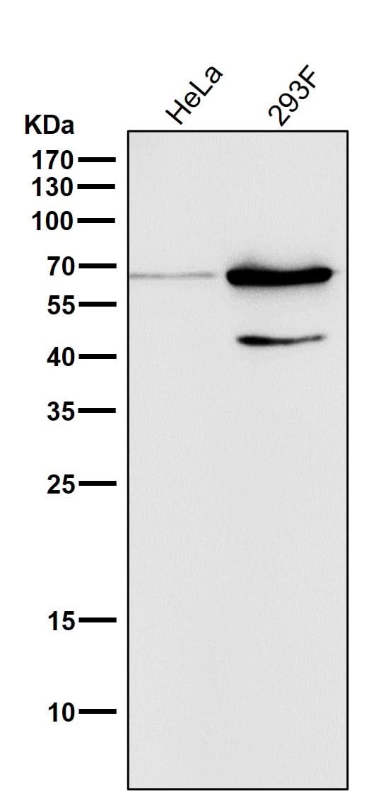 Anti-Phospho-AMPK alpha 2 (S345) PRKAA2 Rabbit Monoclonal Antibody Boster Bio