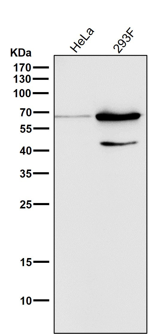 Anti-Phospho-AMPK alpha 2 (S345) PRKAA2 Rabbit Monoclonal Antibody Boster Bio