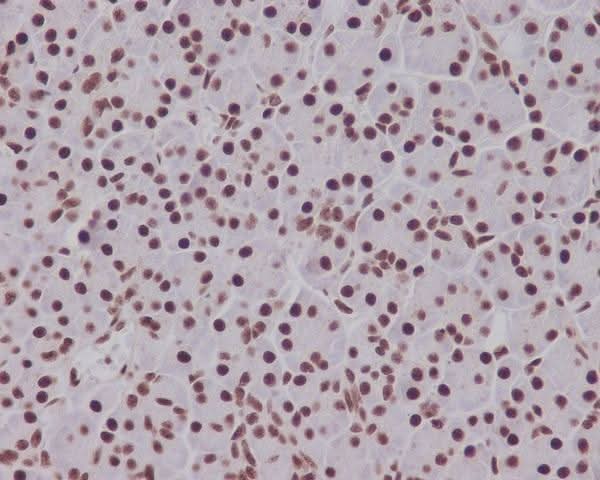 Anti-Phospho-Smad5 (S463/465) Rabbit Monoclonal Antibody Boster Bio