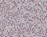 Anti-Phospho-Smad5 (S463/465) Rabbit Monoclonal Antibody Boster Bio