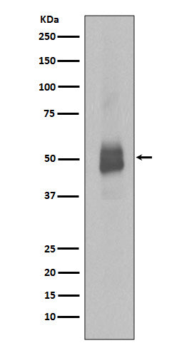 Anti-Phospho-Lyn (Y396) Rabbit Monoclonal Antibody Boster Bio