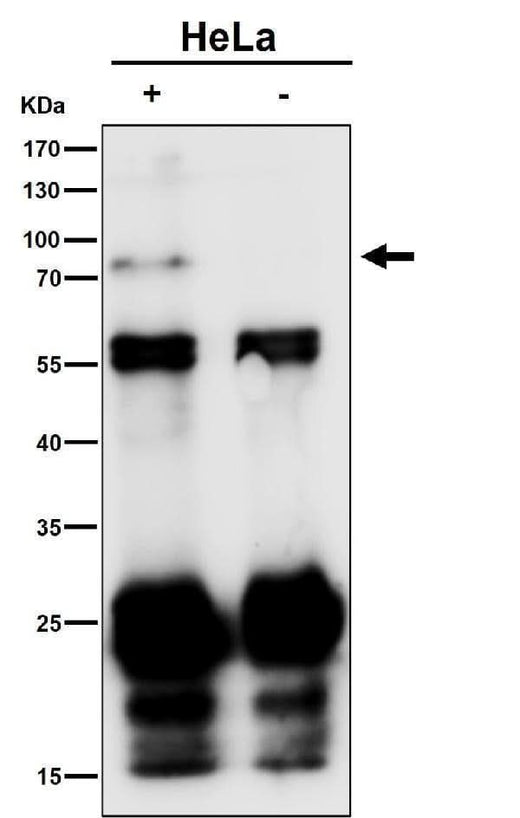 Anti-Phospho-TAK1 (S439) Rabbit Monoclonal Antibody Boster Bio
