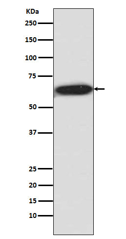Anti-Phospho-S6K1 (T421 + S424) RPS6KB1 Rabbit Monoclonal Antibody Boster Bio