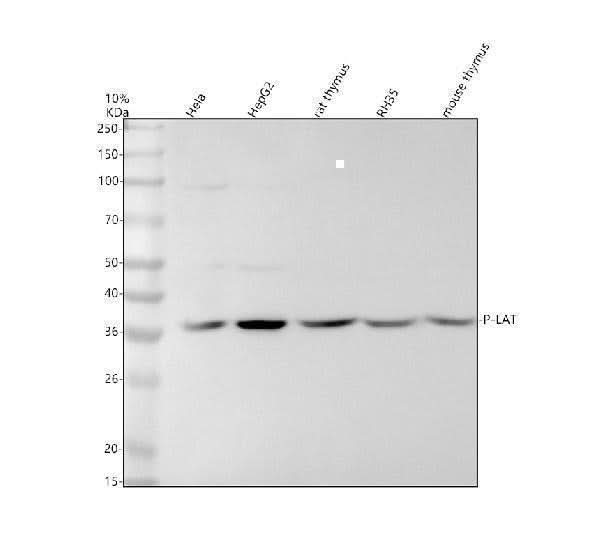 Anti-Phospho-LAT (Y191) Rabbit Monoclonal Antibody Boster Bio