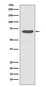 Anti-Phospho-PKC zeta (T560) PRKCZ Rabbit Monoclonal Antibody Boster Bio