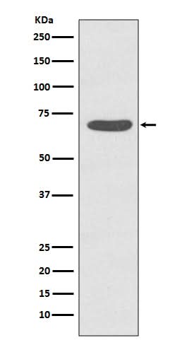 Anti-Phospho-PKC zeta (T560) PRKCZ Rabbit Monoclonal Antibody Boster Bio