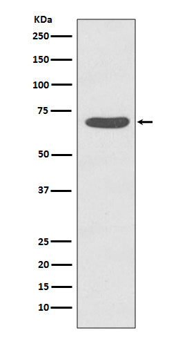 Anti-Phospho-PKC zeta (T560) PRKCZ Rabbit Monoclonal Antibody Boster Bio