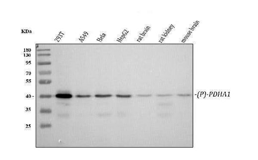 Anti-Phospho-PDHA1 (S293) Rabbit Monoclonal Antibody Boster Bio