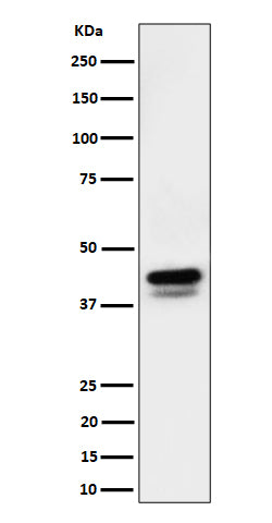 Anti-Phospho-c-Jun (S73)+JunD (S100) Rabbit Monoclonal Antibody Boster Bio