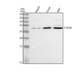 Anti-Phospho-RPA2 (T21) Rabbit Monoclonal Antibody Boster Bio