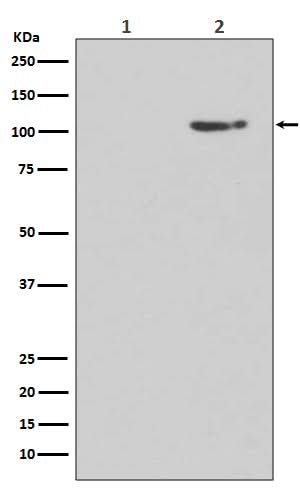 Anti-Phospho-GluR1 (S845) GRIA1 Rabbit Monoclonal Antibody Boster Bio
