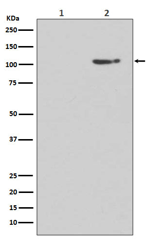 Anti-Phospho-GluR1 (S845) GRIA1 Rabbit Monoclonal Antibody Boster Bio