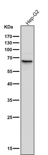 Anti-Phospho-PAK1/2/3 (S144+S141+S139) PAK3 Rabbit Monoclonal Antibody Boster Bio