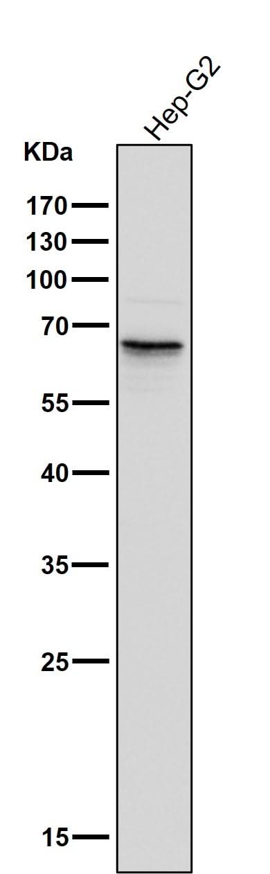 Anti-Phospho-PAK1/2/3 (S144+S141+S139) PAK3 Rabbit Monoclonal Antibody Boster Bio